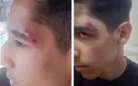 واکنش آموزش‌وپرورش ایلام به شایعه تنبیه دانش‌آموز / درگیری بین دو دانش آموز بوده نه معاون با آنها!
