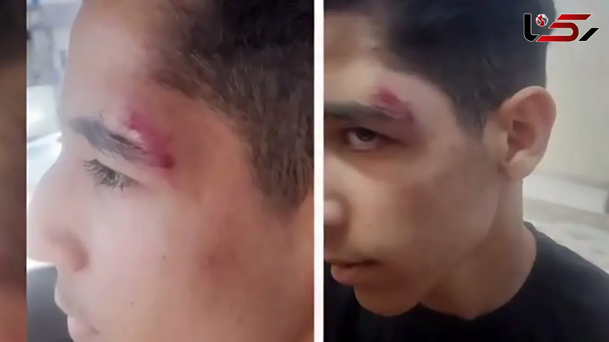 واکنش آموزش‌وپرورش ایلام به شایعه تنبیه دانش‌آموز / درگیری بین دو دانش آموز بوده نه معاون با آنها!