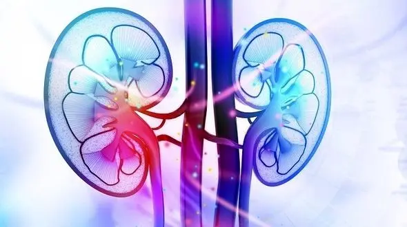 دشمن سلامت کلیه ها را بشناسید