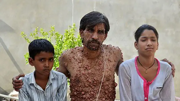 ارثیه وحشتناک و مشمئز کننده که برای مرد جوان به جا ماند! + تصاویر 