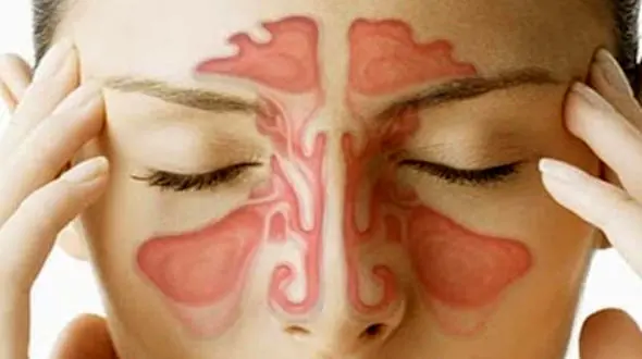 چطور از شر گرفتگی بینی خلاص شویم؟