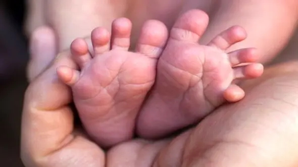 عکس/ تولد حیرت انگیز یک دختر عجیب الخلقه با 4 پا و باز شدن پای او به سیرک/ زندگی این دختر سراسر شگفتی بود!