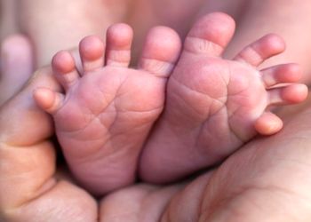 عکس/ تولد حیرت انگیز یک دختر عجیب الخلقه با 4 پا و باز شدن پای او به سیرک/ زندگی این دختر سراسر شگفتی بود!
