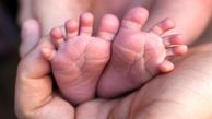 عکس/ تولد حیرت انگیز یک دختر عجیب الخلقه با 4 پا و باز شدن پای او به سیرک/ زندگی این دختر سراسر شگفتی بود!