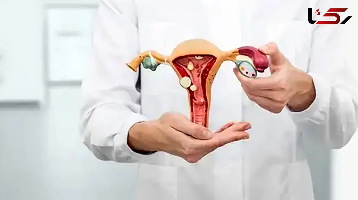 سرطان رحم چیست؟