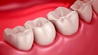 دلایل تغییر رنگ دندان + فوت و فن سفیدی دندان 