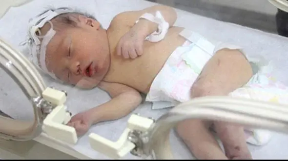 قطع نخاع نوزاد ۵ ماهه گلستانی بر اثر شکستن قلنج! / خود درمانی‌های جاهلانه همچنان قربانی می‌گیرد!