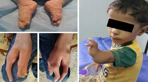 تولد نوزادان عجیب‌الخلقه در کنار پایگاه های نظامی+ عکس