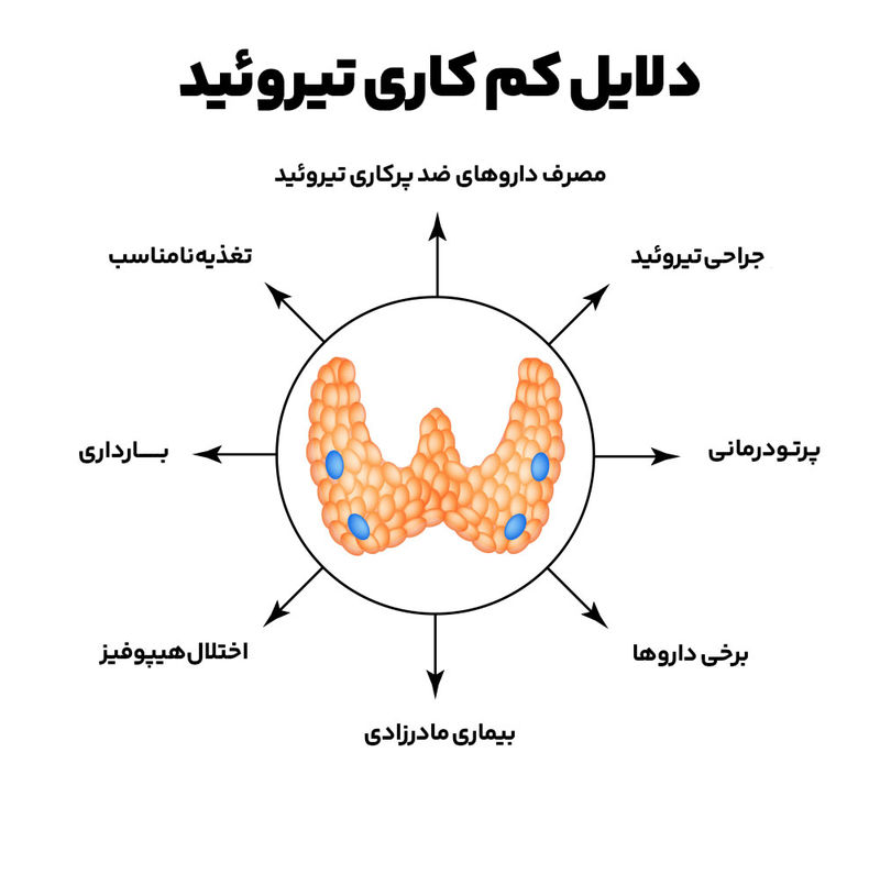 کم کاری تیروئید