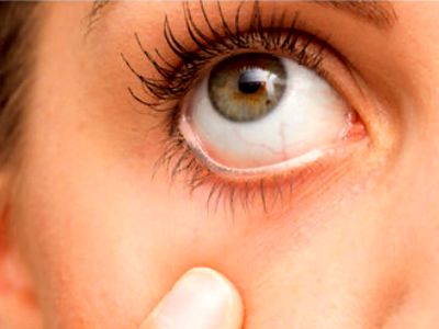 چگونه علائم بیماری کلیوی را در چشم‌ ها تشخیص دهیم؟