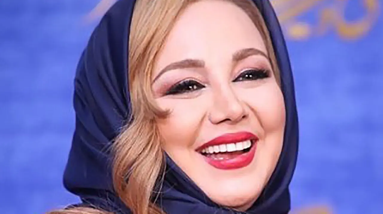  بهنوش بختیاری چه زود پیر شد + عکس باورنکردنی از چهره داغون خانم بازیگر حاشیه ساز !