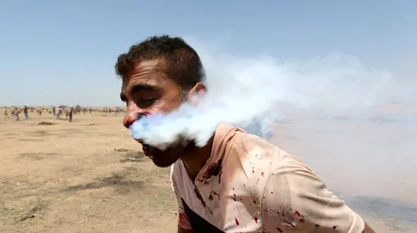 حمله وحشتناک نظامیان صهیونیست به یک فلسطینی با گاز اشک‌آور + تصاویر