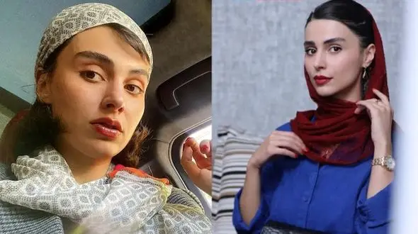 شباهت خیره‌کننده لاله مرزبان بازیگر سریال آبان و بدل معروف ترکیه‌ای‌اش / کدام خانم بازیگر زیباتر است؟ / شما قضاوت کنید