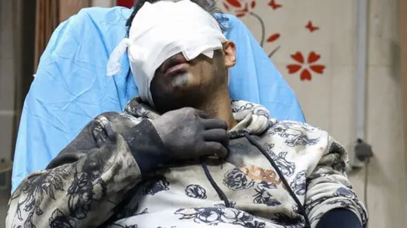 انفجار مواد منفجره در پشت بام یک خانه در اصفهان / 3 پسر نوجوان سوختند