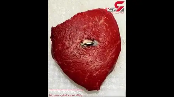 فاجعه بلعیدن باتری‌های سکه‌ای توسط کودکان + فیلم