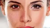 این 2 ویتامین پوست را احیا می‌ کند