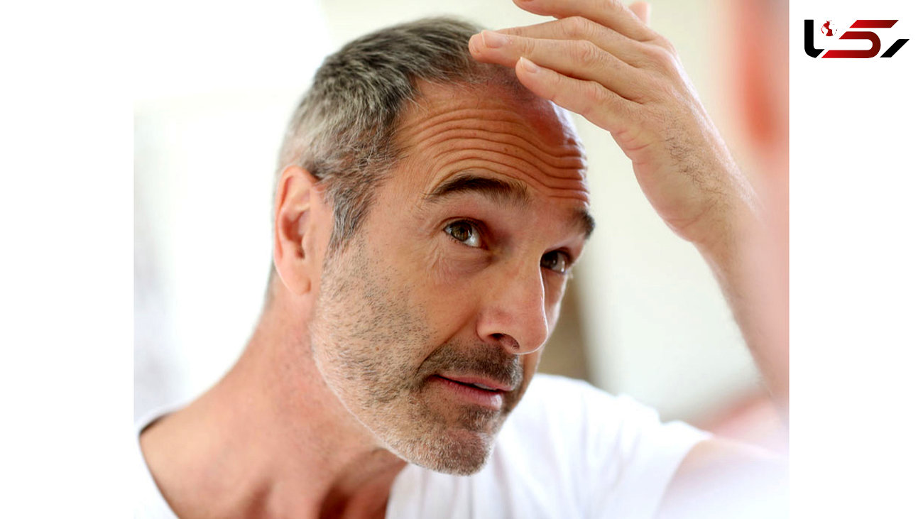  نوشدارویی برای جلوگیری از ریزش مو
