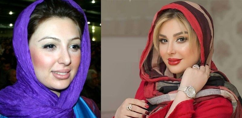 نیوشا ضیغمی
