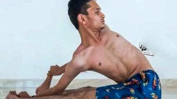 بدن این پسر 18 ساله هندی استخوان ندارد/پسر لاستیکی نام گرفت!+تصاویر