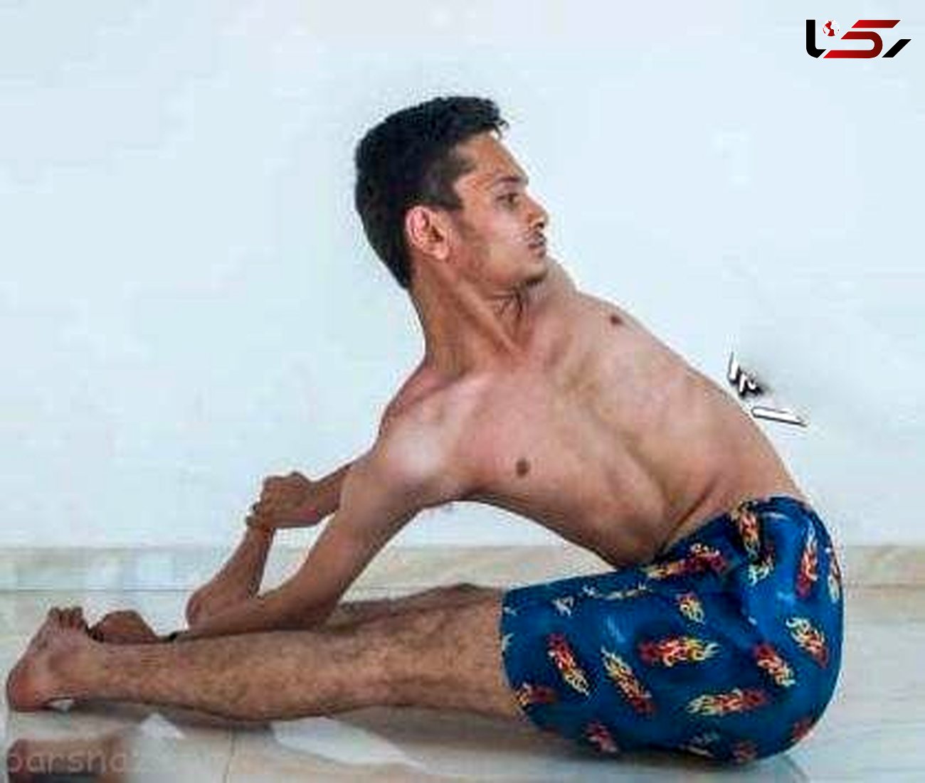 بدن این پسر 18 ساله هندی استخوان ندارد/پسر لاستیکی نام گرفت!+تصاویر