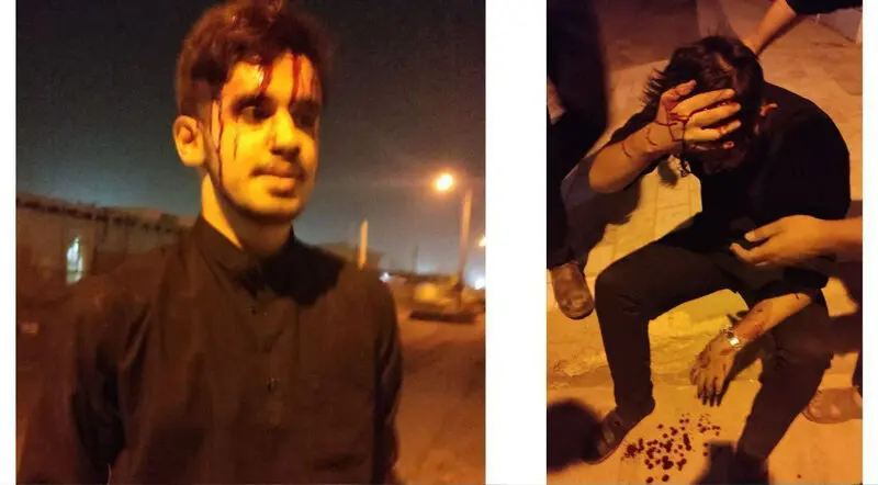 حمله به مداح