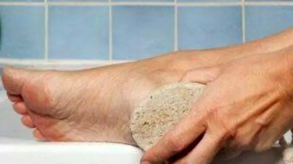 درمان ترک پا با روش های خانگی