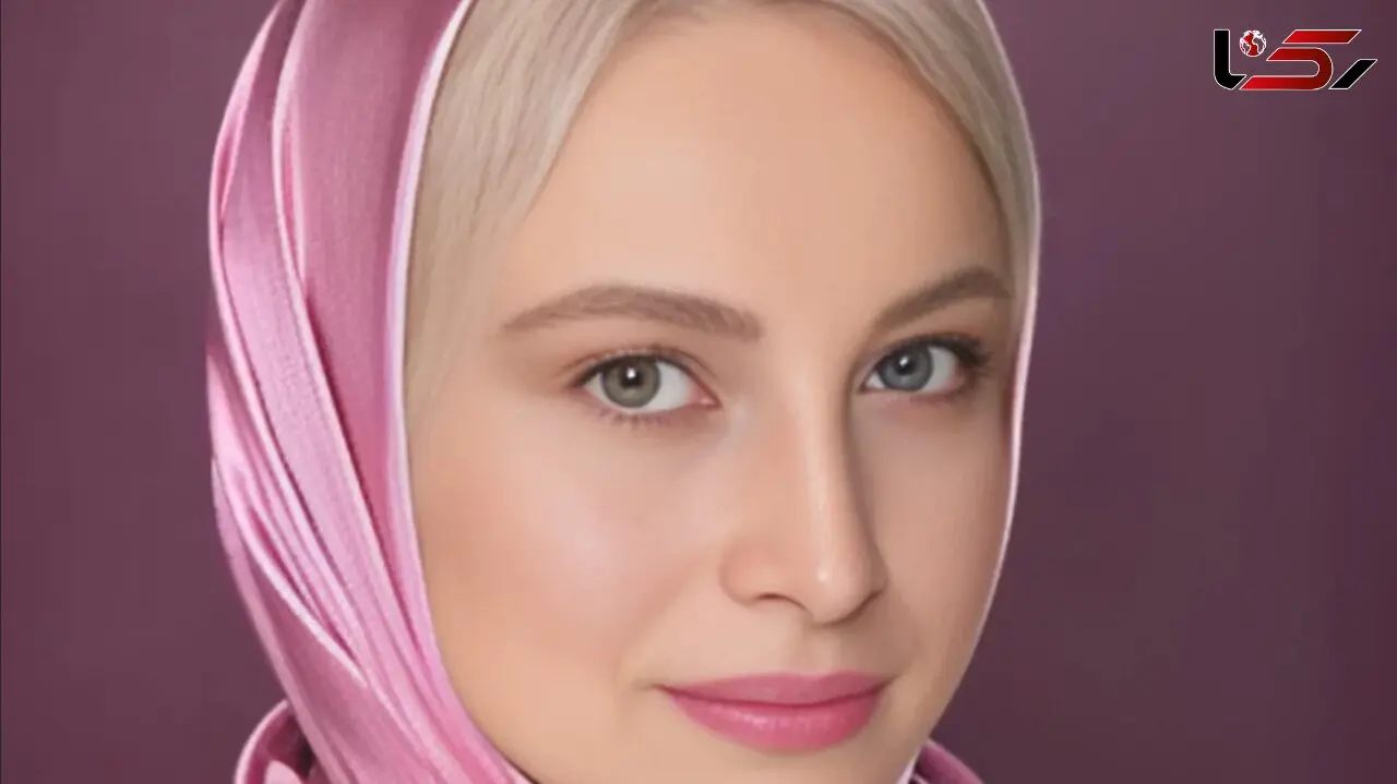 جراحی زیبایی جنجالی مریم کاویانی / خانم بازیگر واکنش نشان داد !