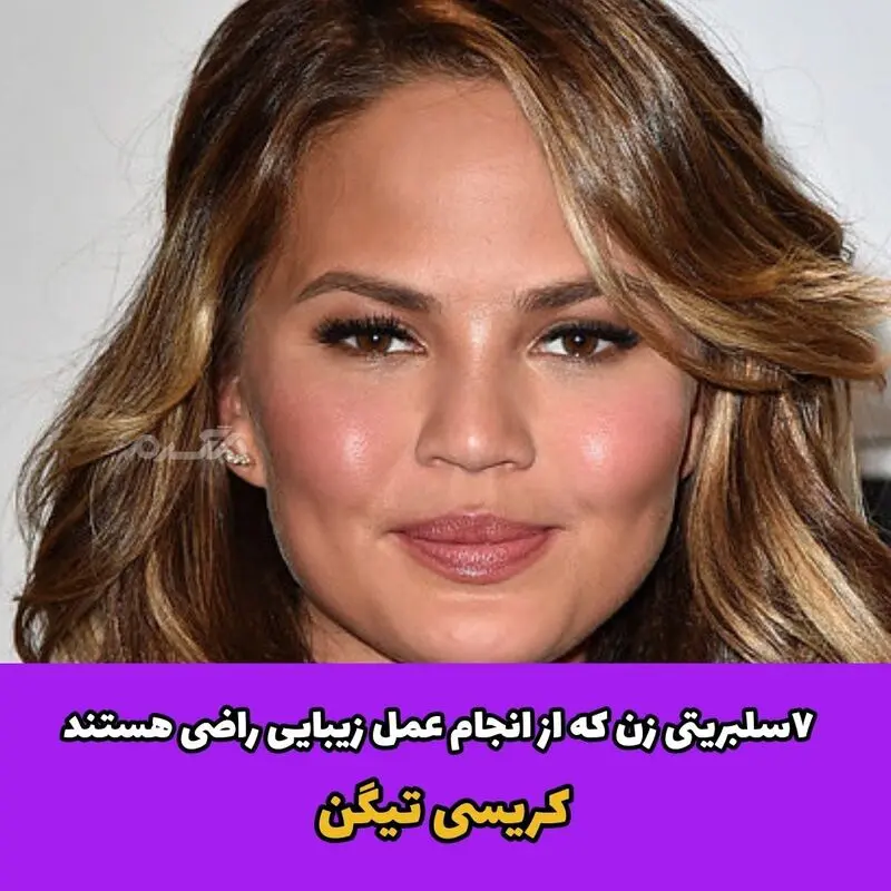 ۷ سلبریتی زن که از انجام عمل زیبایی راضی هستند