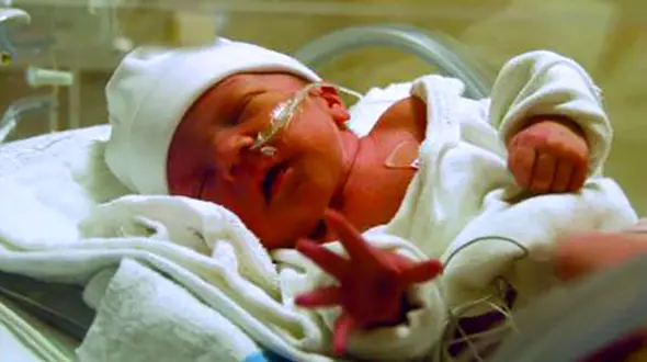 سزارین خطر ابتلا به اوتیسم را یک سوم افزایش می‌دهد