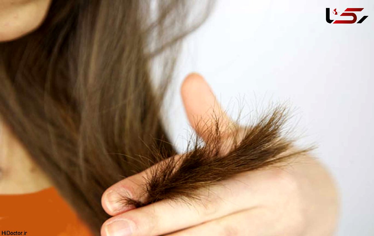 ترفندهای خانگی برای درمان موهای شکننده