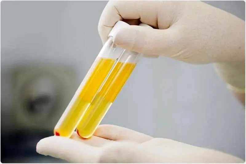 پلاکت خون (1)