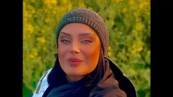چهره وحشتناک صبا راد بعد  عمل زیبایی ! / خانم مجری واقعا زشت شد !