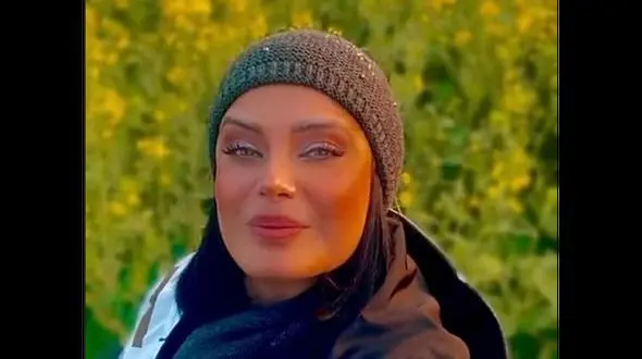 چهره وحشتناک صبا راد بعد  عمل زیبایی ! / خانم مجری واقعا زشت شد !