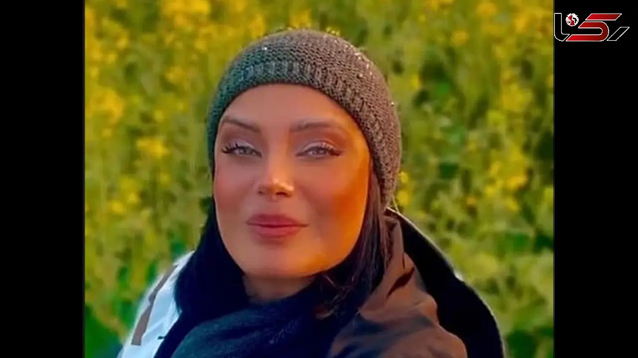 چهره وحشتناک صبا راد بعد  عمل زیبایی ! / خانم مجری واقعا زشت شد !