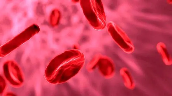 بلایی که بالا بودن آهن خون سرتان می آورد