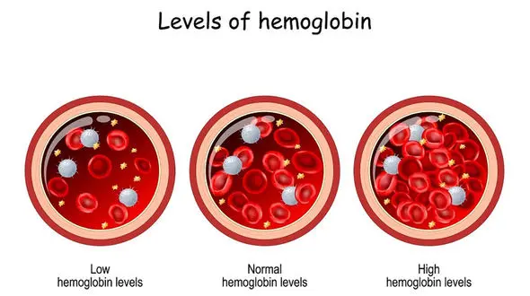 راهکارهای پیشگیری از افزایش هموگلوبین خون / لخته شدن خون را جدی بگیرید