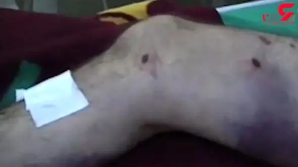 جنایات اردوغان علیه بشریت + فیلم 18+