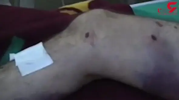 جنایات اردوغان علیه بشریت + فیلم 18+