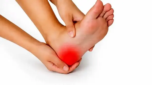 خار پاشنه پا از چیست و چگونه می‌توان درد آن را کاهش داد؟