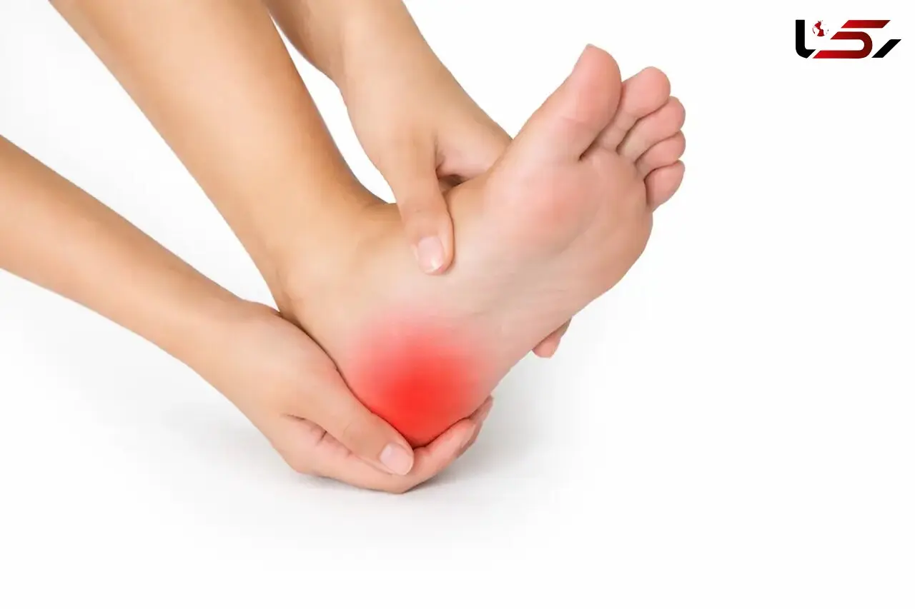 خار پاشنه پا از چیست و چگونه می‌توان درد آن را کاهش داد؟