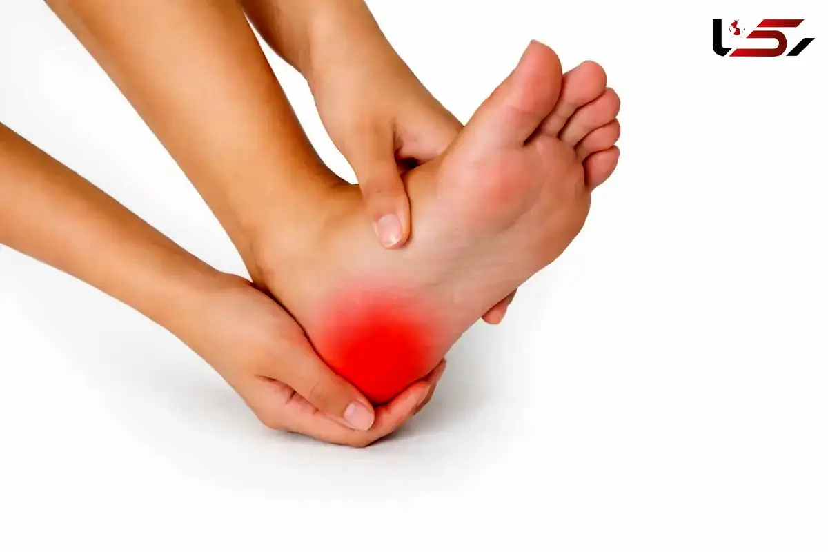 خار پاشنه پا از چیست و چگونه می‌توان درد آن را کاهش داد؟
