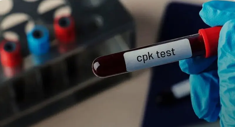 آزمایش CPK