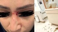 حمله وحشیانه به خانم پرستار در تالش + عکس
