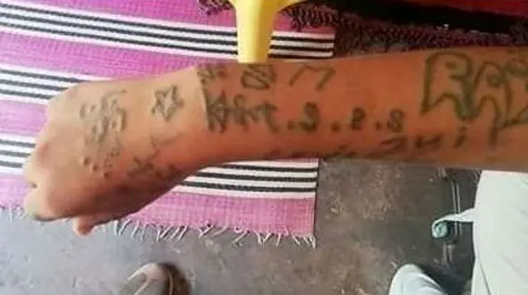 مردان شیطان صفت دستان دختر 17 ساله را بعد از آزار تتو کردند! + تصاویر