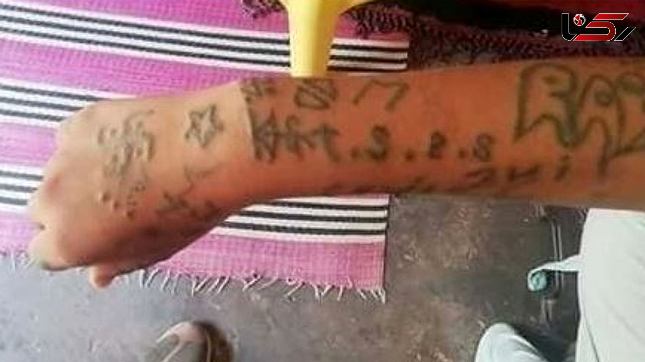 مردان شیطان صفت دستان دختر 17 ساله را بعد از آزار تتو کردند! + تصاویر