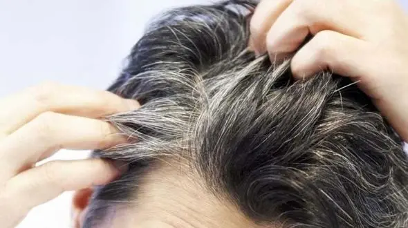 فریب تبلیغات رفع سفیدی مو با شامپو را نخورید!