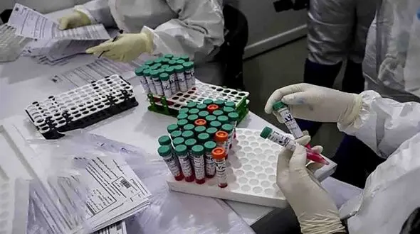 30373 ایرانی در 149 روز گذشته با ابتلا به کرونا جانباختند +  آمار مرگ به تفکیک روزها
