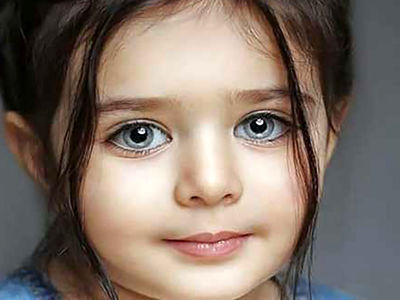 زیباترین دختر ایران زیبایی اش را از دست داد ! + عکس جدید هانا پاک نیت حیرت آور است !