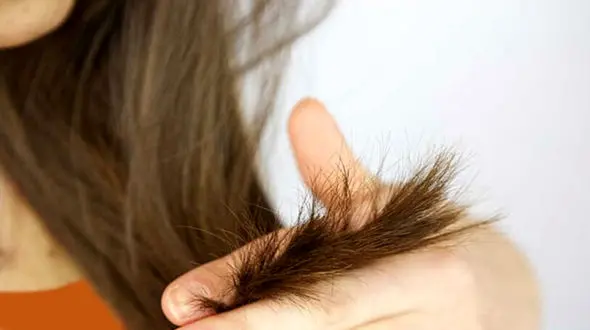 با درمان های طبیعی از شر موخوره خلاص شوید