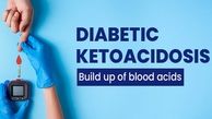 کتواسیدوز دیابتی چیست + راه های پیشگیری